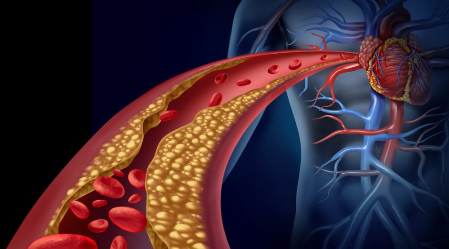 Angiologie Arterien